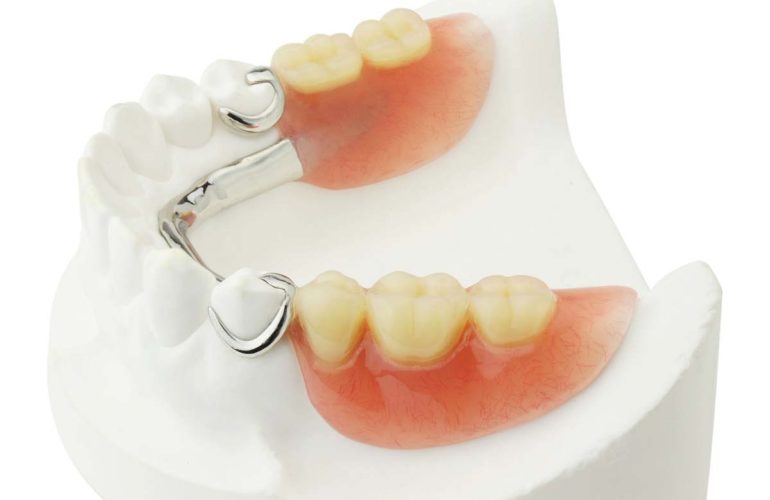 Partial dentures